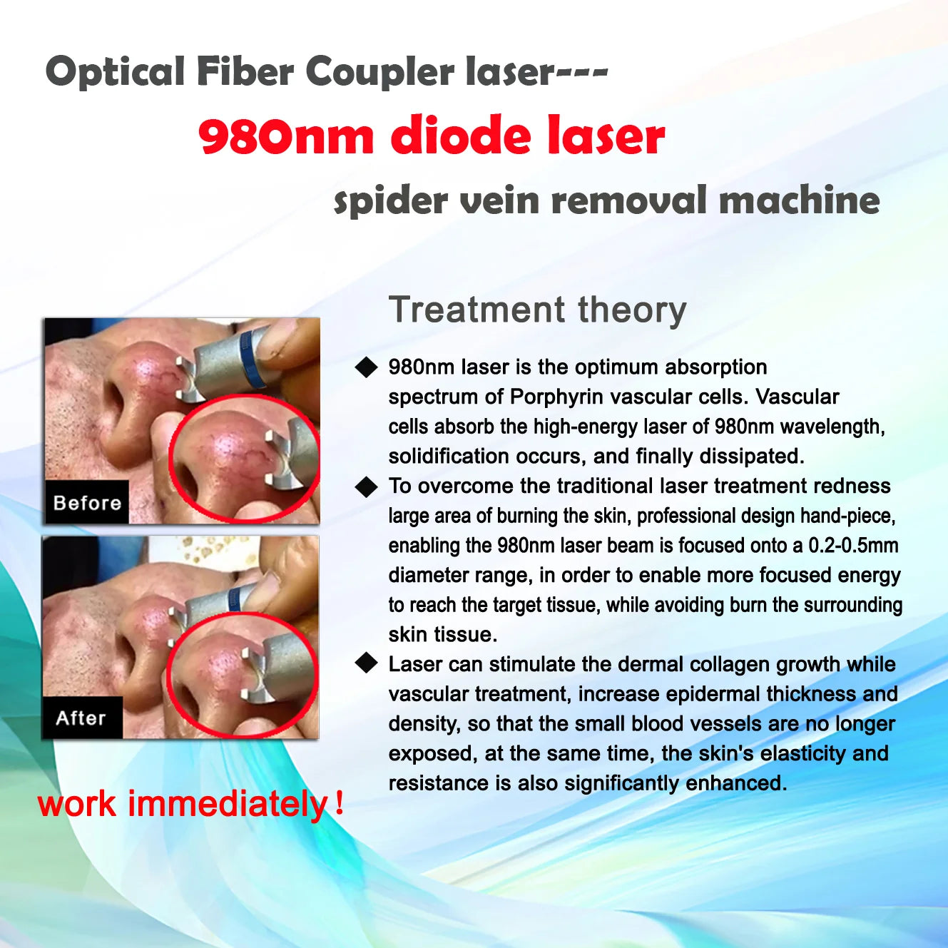 5 in 1 980nm Diode Laser Vascular Removal Machine for Spider Veins & Nail Fungus Treatment Home Beauty Care Equipment 2026