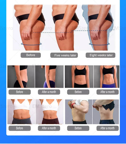NEW UPGRADE EMSzerol+RF(62 ROLLER MASSAGE)therapy Body Weight Loss Slimming Beauty Equipment