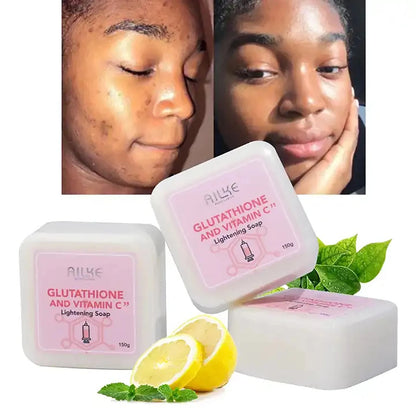 AILKE Whitening Moisturizing Korean Facial And Body Lotion, Reduce Melanin Wrinkles, Vitamin C Dark Spots Remove Skin Care Cream