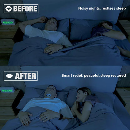 YA4600 Smart Anti Snoring Magnetic Patch Snore Stopper Electric Throat Muscle Stimulator Massager No Snoring Sleepping Aids