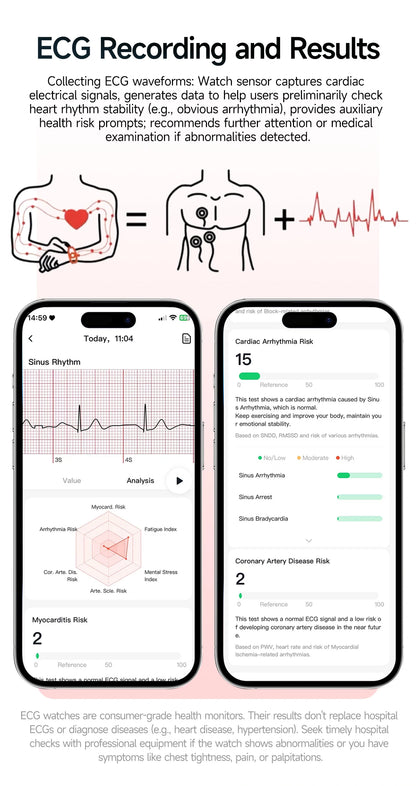 New Professional Health Watch Blood Pressure 2.01"AMOLED Screen Uric Acid Blood Lipids Flashlight Care Smart Watches for Women