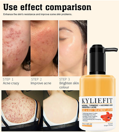 AILKE Natural Turmeric Skin Care Range, Lightening, Cleaning Skin, Moisturizes, Remove Acne and Pimples, Refining Pores