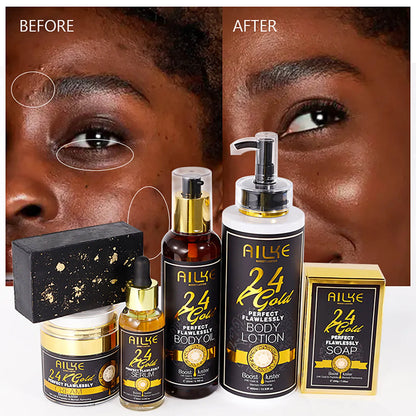 AILKE 24K Whitening Skin Set, Lightening, Remove Black Spots, Melanin, Stains, Even Skin Tone, Moisturizing, for All Skin Types