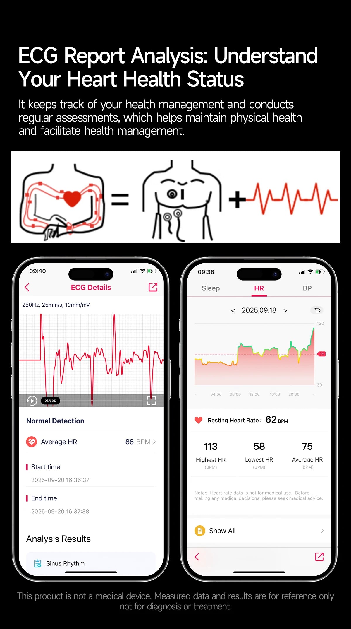 2026New High-end Health Smart Watch For Men Women Blood Lipids Uric Acid Blood Pressure Accurate Data ECG+PPG BT Call Smartwatch