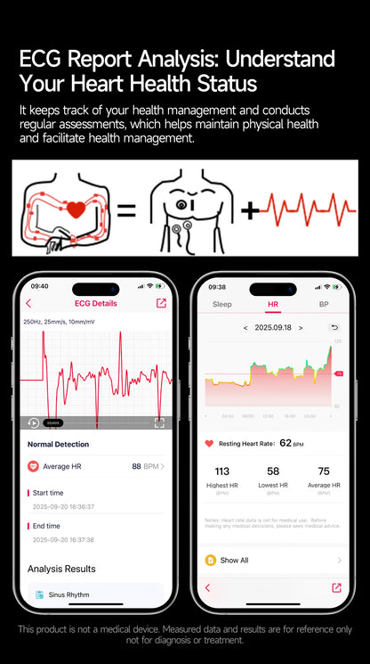 2026New High-end Health Smart Watch For Men Women Blood Lipids Uric Acid Blood Pressure Accurate Data ECG+PPG BT Call Smartwatch