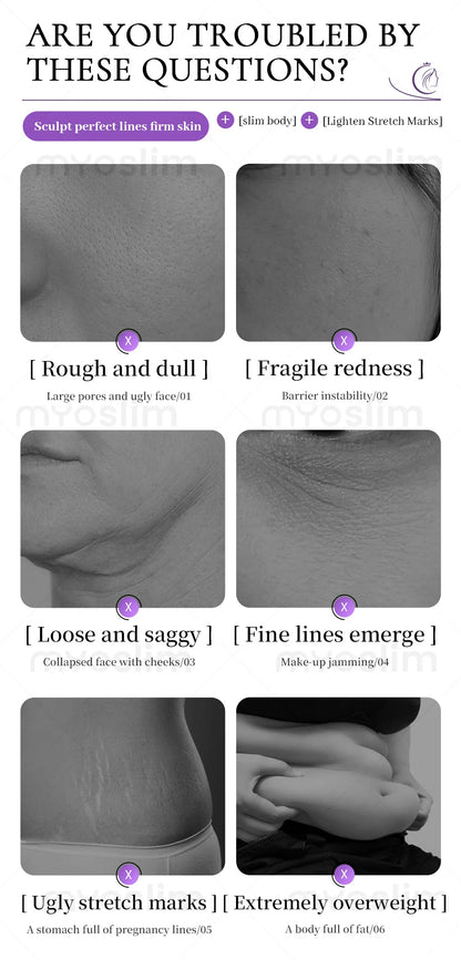 4D Cavitation Beauty Machine for Body Sculpting, Wrinkle Reduction, Contour Refining, Stretch Mark Fading and Cellulite Removal