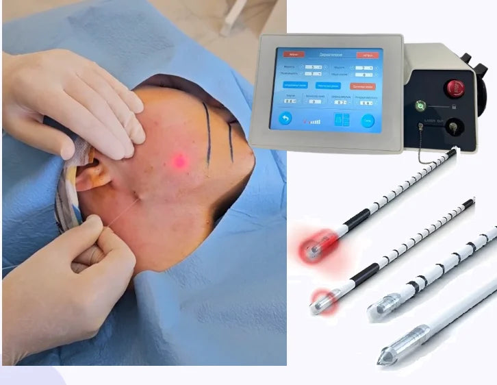 980nm 1470nm Laser Facial Tightening Device Fiber Optic Lifting Neck Sculpting Skin Firming Beauty Equipment