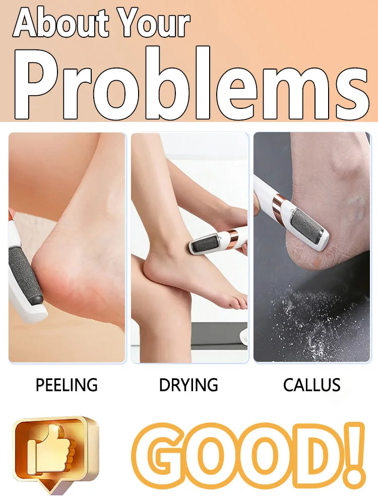 Electric foot file, electric callus remover, foot scrubber, foot care tools, pedicure tools, removes dead skin. Unisex.