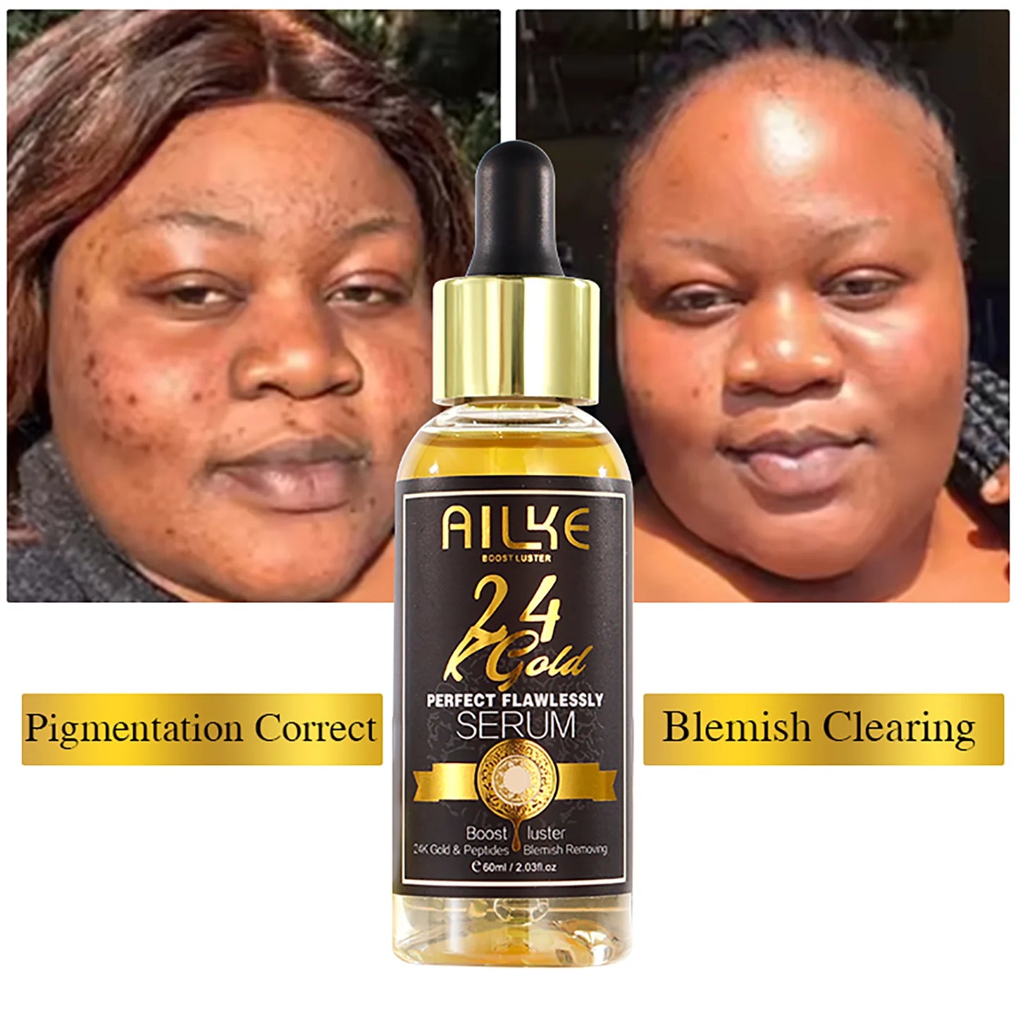 AILKE 24K Whitening Skin Set, Lightening, Remove Black Spots, Melanin, Stains, Even Skin Tone, Moisturizing, for All Skin Types
