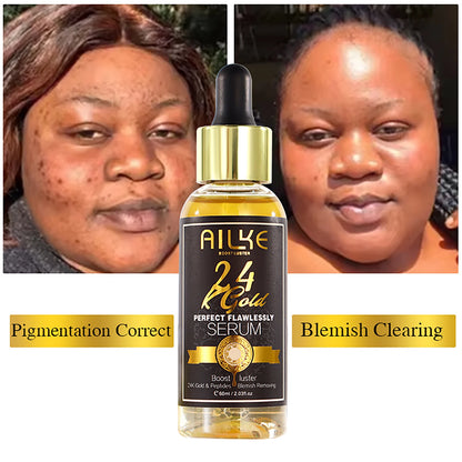 AILKE 24K Whitening Skin Set, Lightening, Remove Black Spots, Melanin, Stains, Even Skin Tone, Moisturizing, for All Skin Types