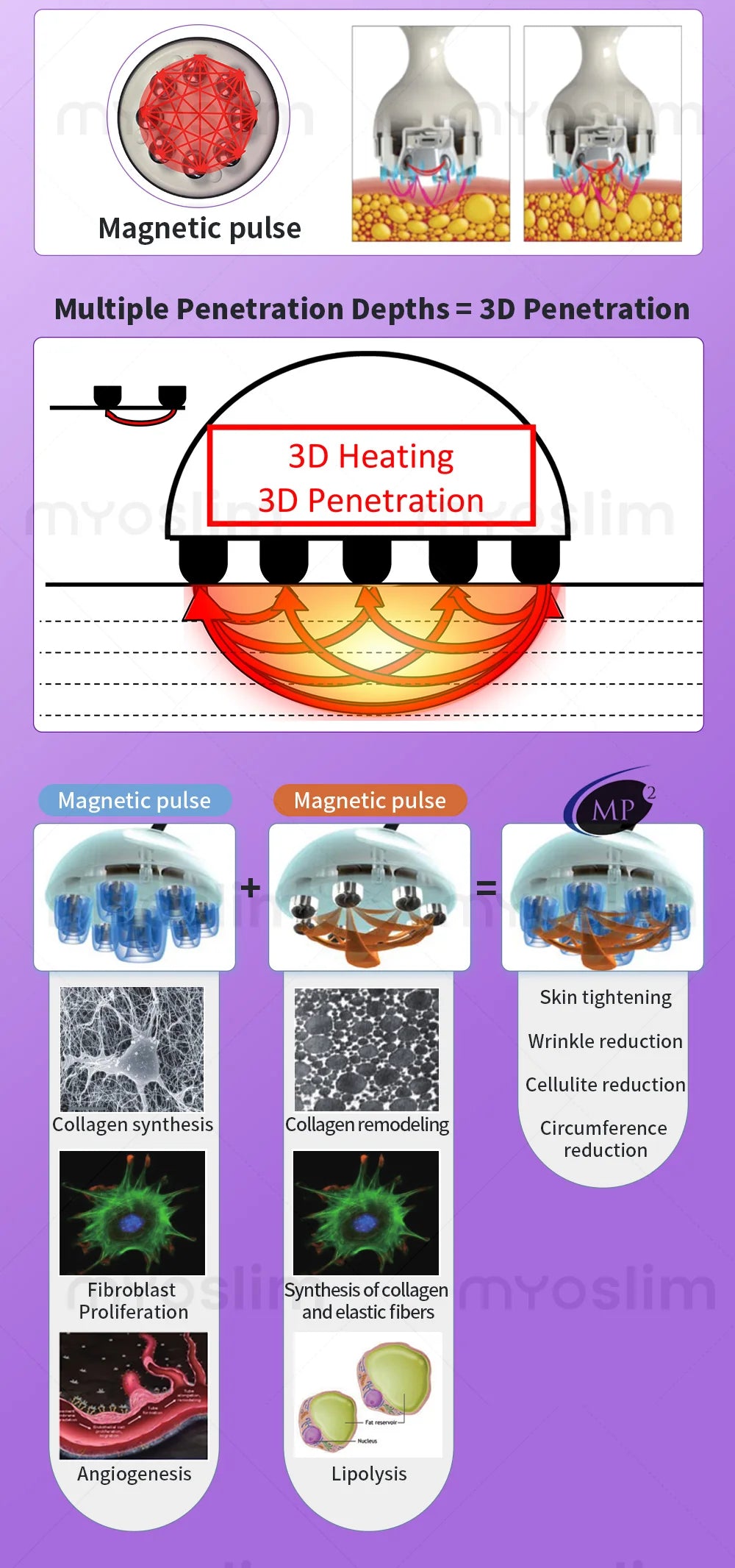 4D Cavitation Beauty Machine for Body Sculpting, Wrinkle Reduction, Contour Refining, Stretch Mark Fading and Cellulite Removal