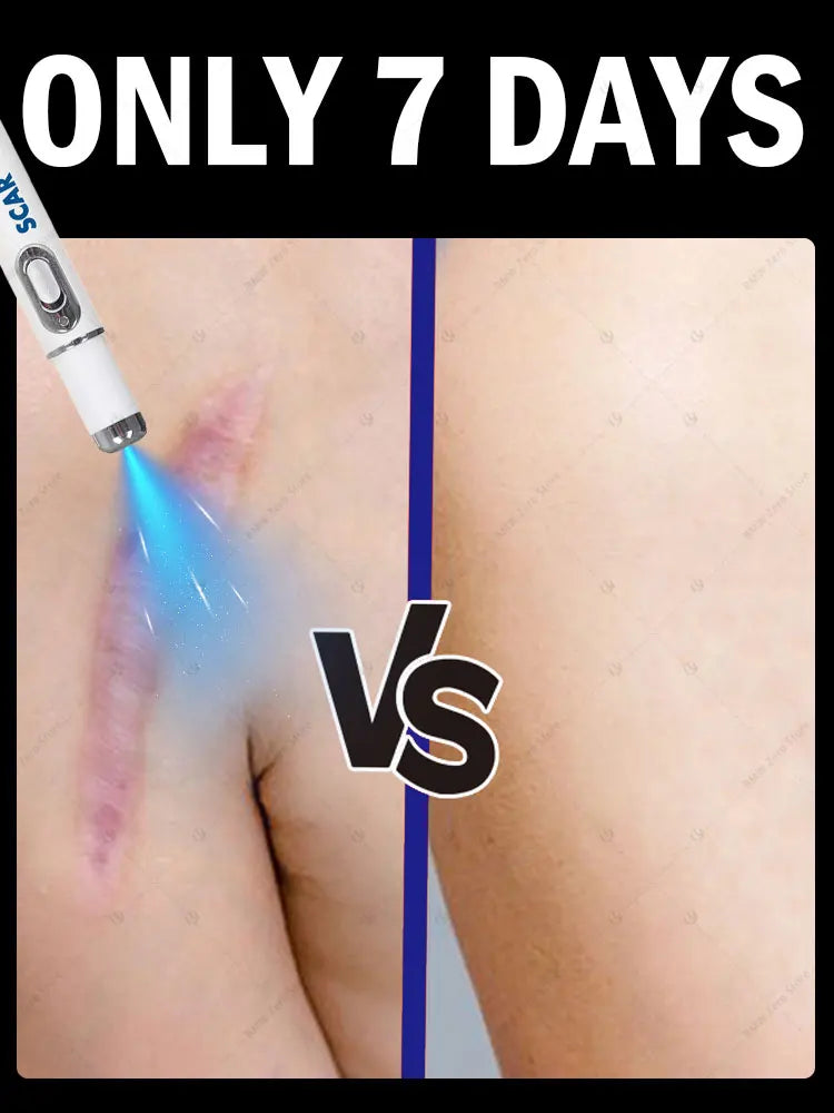 Silicone-based scar laser for skin care soothes discomfort daily use