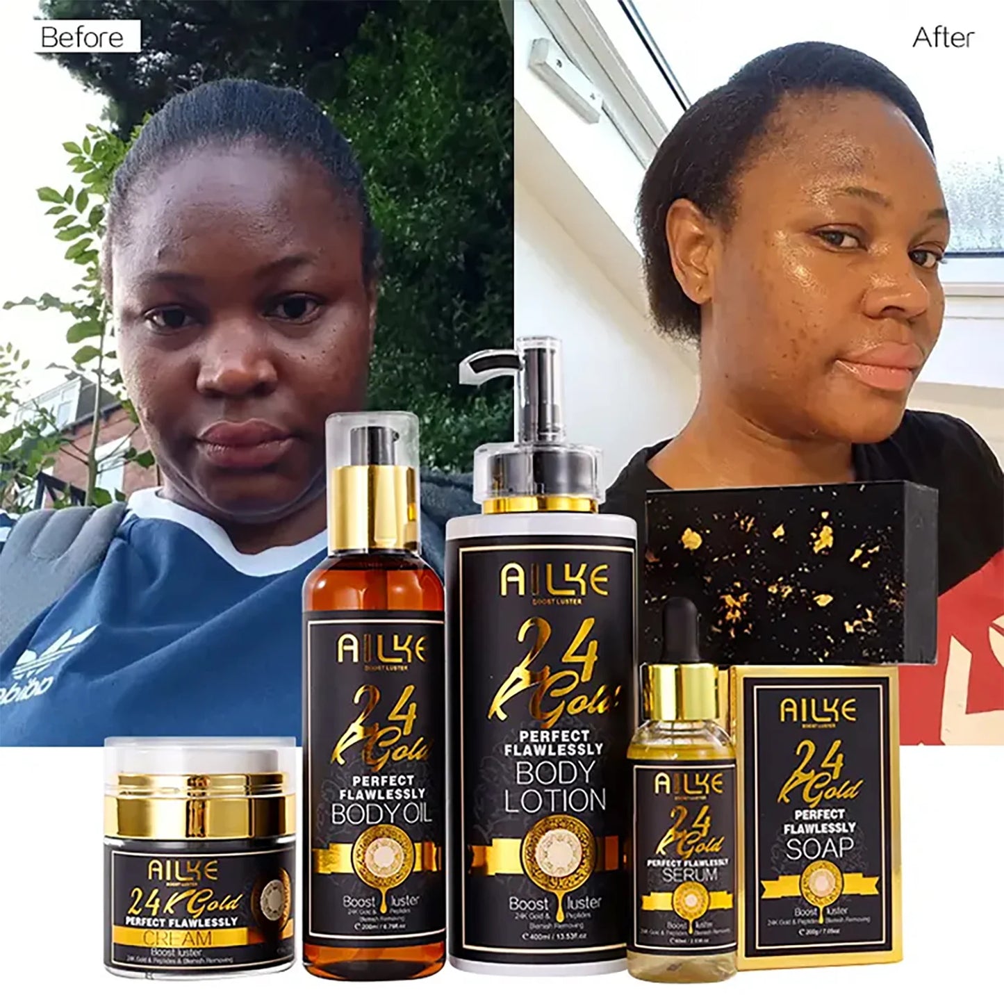 AILKE 24K Whitening Skin Set, Lightening, Remove Black Spots, Melanin, Stains, Even Skin Tone, Moisturizing, for All Skin Types