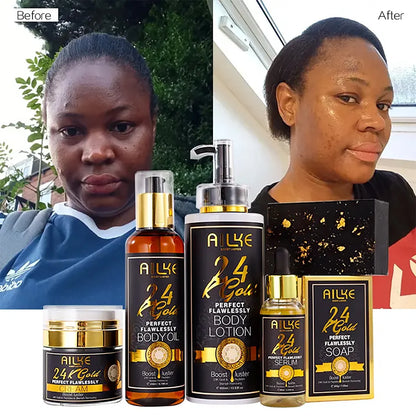 AILKE 24K Whitening Skin Set, Lightening, Remove Black Spots, Melanin, Stains, Even Skin Tone, Moisturizing, for All Skin Types