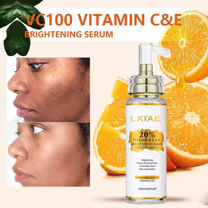 AILKE Lightening Body Cream, With Vitamin C, Hyaluronic Acid, Shea Butter, Reduce Black Spots, Even Skin Tone, Hydration Lotion