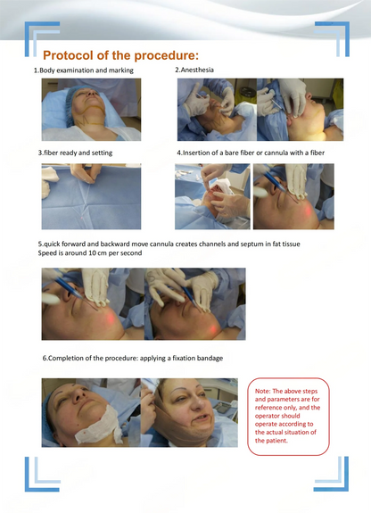 980nm 1470nm Laser Facial Tightening Device Fiber Optic Lifting Neck Sculpting Skin Firming Beauty Equipment