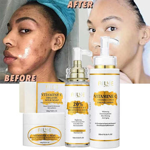 AILKE Lightening Body Cream, With Vitamin C, Hyaluronic Acid, Shea Butter, Reduce Black Spots, Even Skin Tone, Hydration Lotion